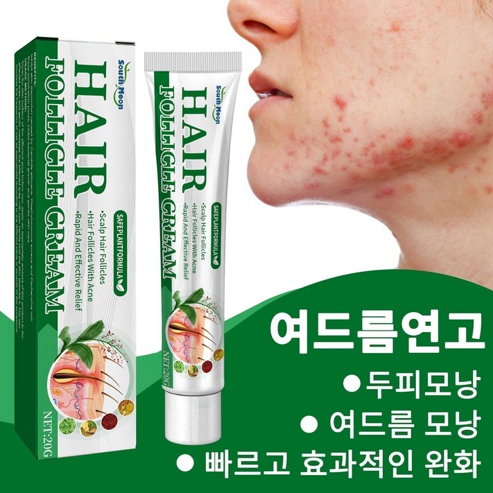 여드름연고 여드름치료 등드름피부얼굴 여드름 HM009 여드름연고 여드름치료 등드름피부얼굴 여드름 HM009