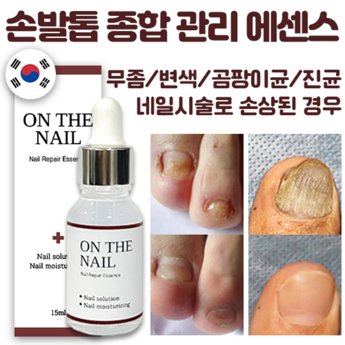 명품 온더네일 에센스 네일 트리트먼트 손발톱 강화 곰팡이균 무좀 변색 젤네일시술로 인한 손톱 발톱 손상 리페어 에센스 nail repair nail fungus treatment, 15ml, 1개