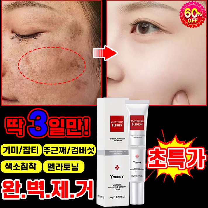 [피부과 전용] 기미크림 기미 잡티 주근깨 검버섯 제거 크림 멜라토닝 멜라논 크림 들깨기미크림 얼굴 색소침착 착색 화이트닝 포장증정