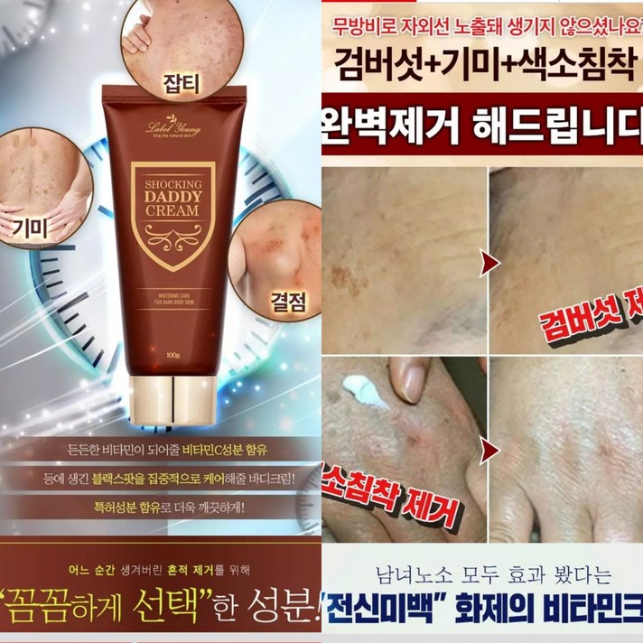 특허 기미지우게 잡티제거 크림 100g/검버섯 잡티 특허 피부복구, 2)쇼킹 클리어 크림100g1+1 (상세설명 확인구매)