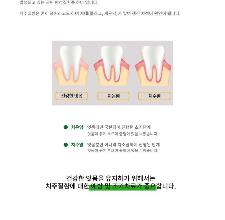 [박사.  껌] 안티프라그 뉴 머마스틱 치약 120g